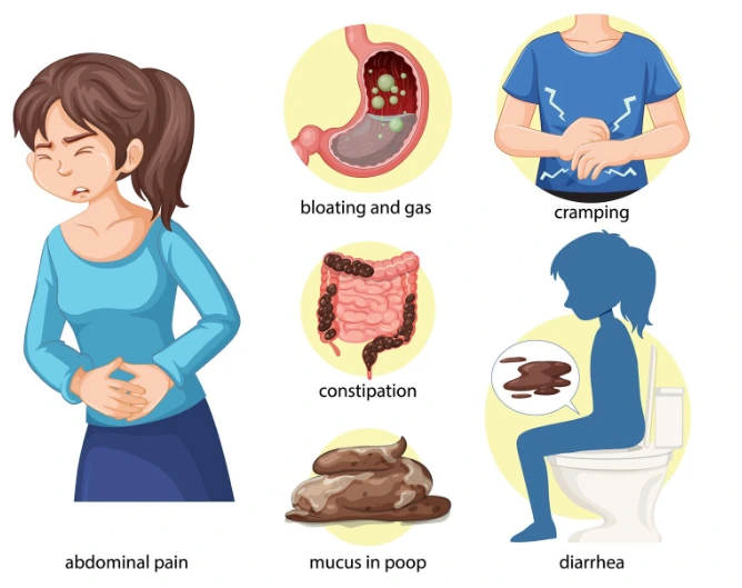 Irritable Bowel Syndrome